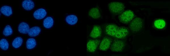 Anti-AP2 gamma/TFAP2C Antibody