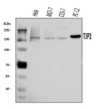 TJP2/ZO2 Antibody