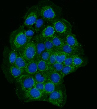 Anti-TJP2/ZO2 Antibody