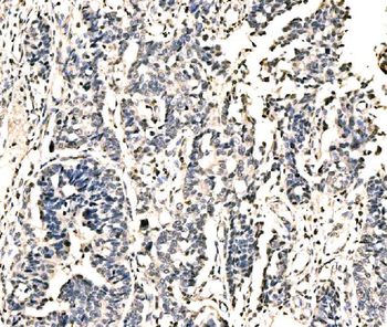 Anti-KIAA1429/VIRMA Antibody