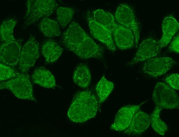 Anti-WNT8B Antibody