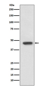 FOXP3 Rabbit Monoclonal Antibody