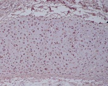 Anti-Aggrecan Rabbit Monoclonal Antibody