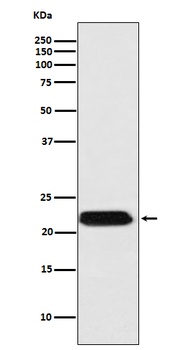 Anti-FTMT Rabbit Monoclonal Antibody