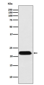 FTMT Rabbit Monoclonal Antibody