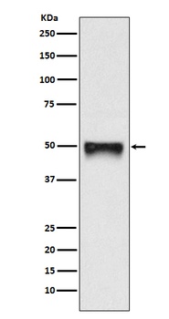 CD209 Rabbit Monoclonal Antibody