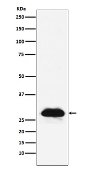 Carbonic anhydrase 2 Rabbit Monoclonal Antibody
