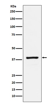 Anti-RASSF1 Rabbit Monoclonal Antibody