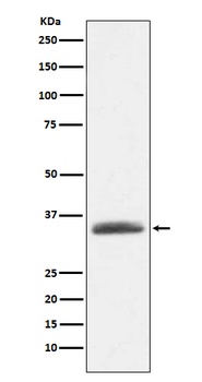 Anti-AMBP Rabbit Monoclonal Antibody