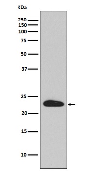 Anti-SNAP23 Rabbit Monoclonal Antibody