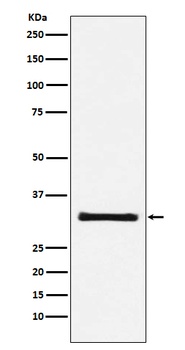 GC1q R Rabbit Monoclonal Antibody