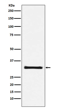 Anti-GC1q R Rabbit Monoclonal Antibody
