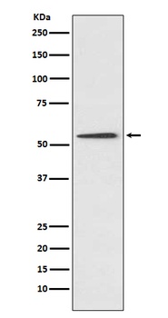 Protein C Rabbit Monoclonal Antibody