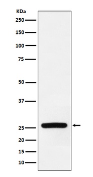 Superoxide Dismutase 3 Rabbit Monoclonal Antibody