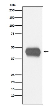 CD1a Rabbit Monoclonal Antibody