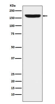 Anti-REST / NRSF Rabbit Monoclonal Antibody