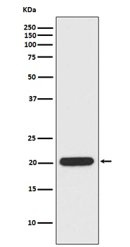 Anti-Ferritin Heavy Chain Rabbit Monoclonal Antibody