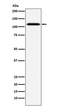 Anti-CD30 Rabbit Monoclonal Antibody