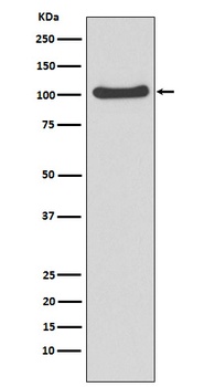 Anti-MVP Rabbit Monoclonal Antibody