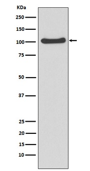 MVP Rabbit Monoclonal Antibody