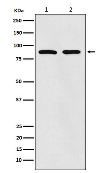 TPOR Rabbit Monoclonal Antibody