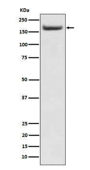 Anti-IRS2 Rabbit Monoclonal Antibody
