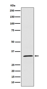 UCP1+UCP3 Rabbit Monoclonal Antibody