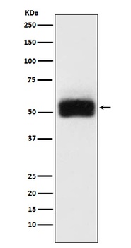 MMP17 Rabbit Monoclonal Antibody