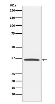 Anti-E2F6 Rabbit Monoclonal Antibody