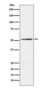 Anti-MEIS2 Rabbit Monoclonal Antibody