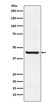 Septin 2 Rabbit Monoclonal Antibody