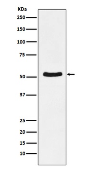 Anti-DDX6 Rabbit Monoclonal Antibody