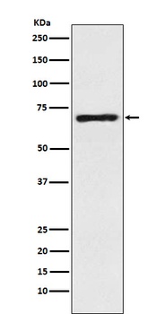 SLC6A1 / GAT1 Rabbit Monoclonal Antibody