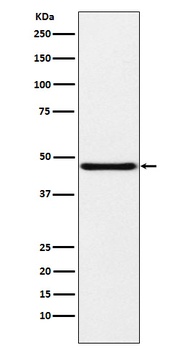 NPHS2 Rabbit Monoclonal Antibody