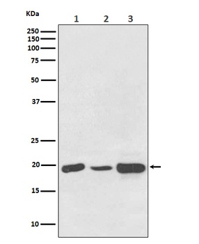 NDUFB8 Rabbit Monoclonal Antibody
