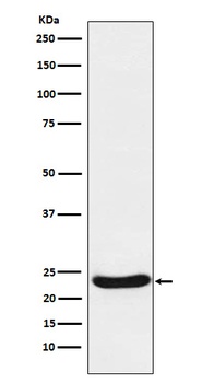 Anti-UQCRFS1 Rabbit Monoclonal Antibody