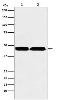 KMT1B / SUV39H2 Rabbit Monoclonal Antibody
