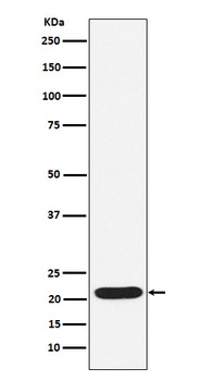Anti-SOCS2 Rabbit Monoclonal Antibody