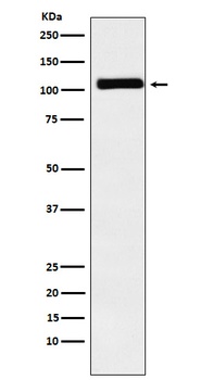 Anti-MIB1 / DIP1 Rabbit Monoclonal Antibody