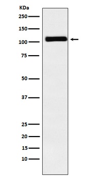 MIB1 / DIP1 Rabbit Monoclonal Antibody