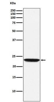 Tetranectin Rabbit Monoclonal Antibody