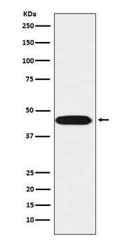 Anti-LIS1 Rabbit Monoclonal Antibody