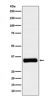 Anti-IGFBP2 Rabbit Monoclonal Antibody
