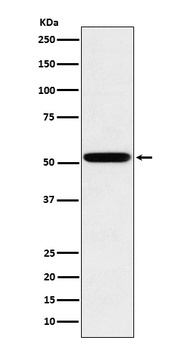 Anti-Human IgG2 Rabbit Monoclonal Antibody
