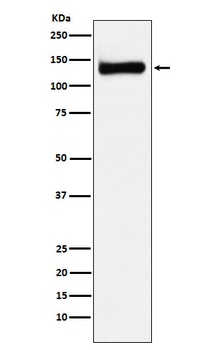 Anti-RENT1 / hUPF1 Rabbit Monoclonal Antibody