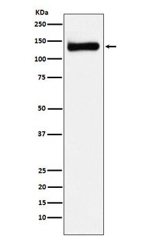 RENT1 / hUPF1 Rabbit Monoclonal Antibody