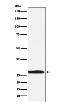 Anti-Carbonic Anhydrase 1 Rabbit Monoclonal Antibody