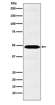 IL13 receptor alpha 1 Rabbit Monoclonal Antibody