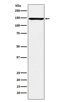 Anti-ORP150 Rabbit Monoclonal Antibody