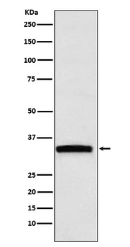 GDF15 Rabbit Monoclonal Antibody